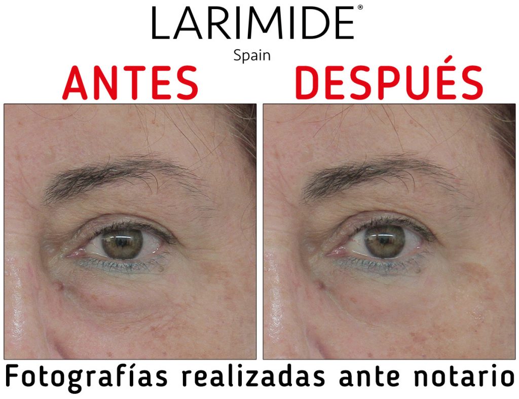 Larimide