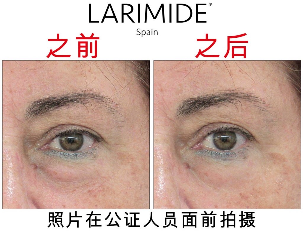Larimide