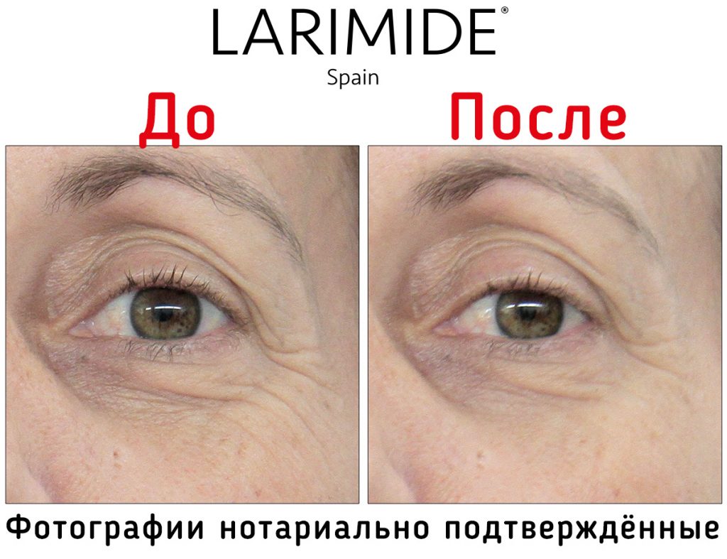Larimide