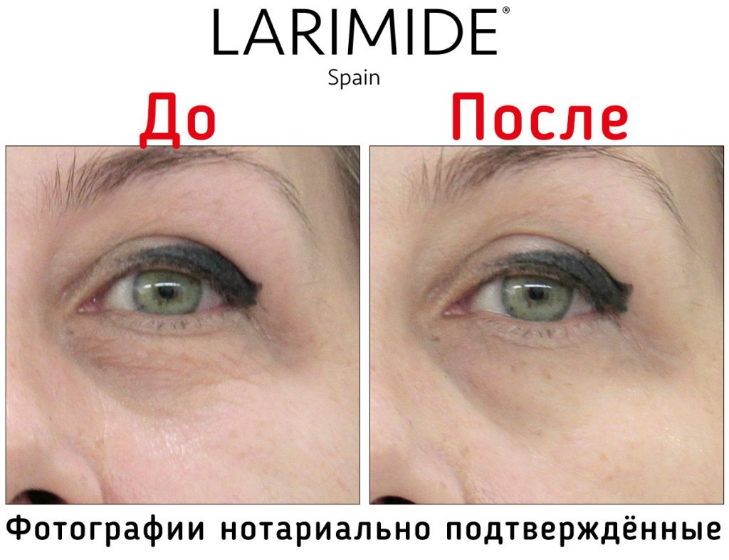 Larimide