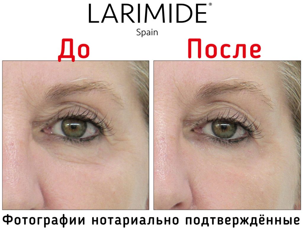 Larimide