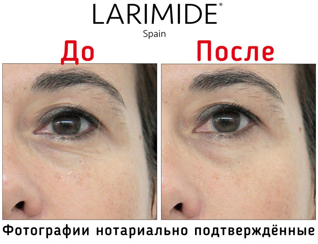 Larimide