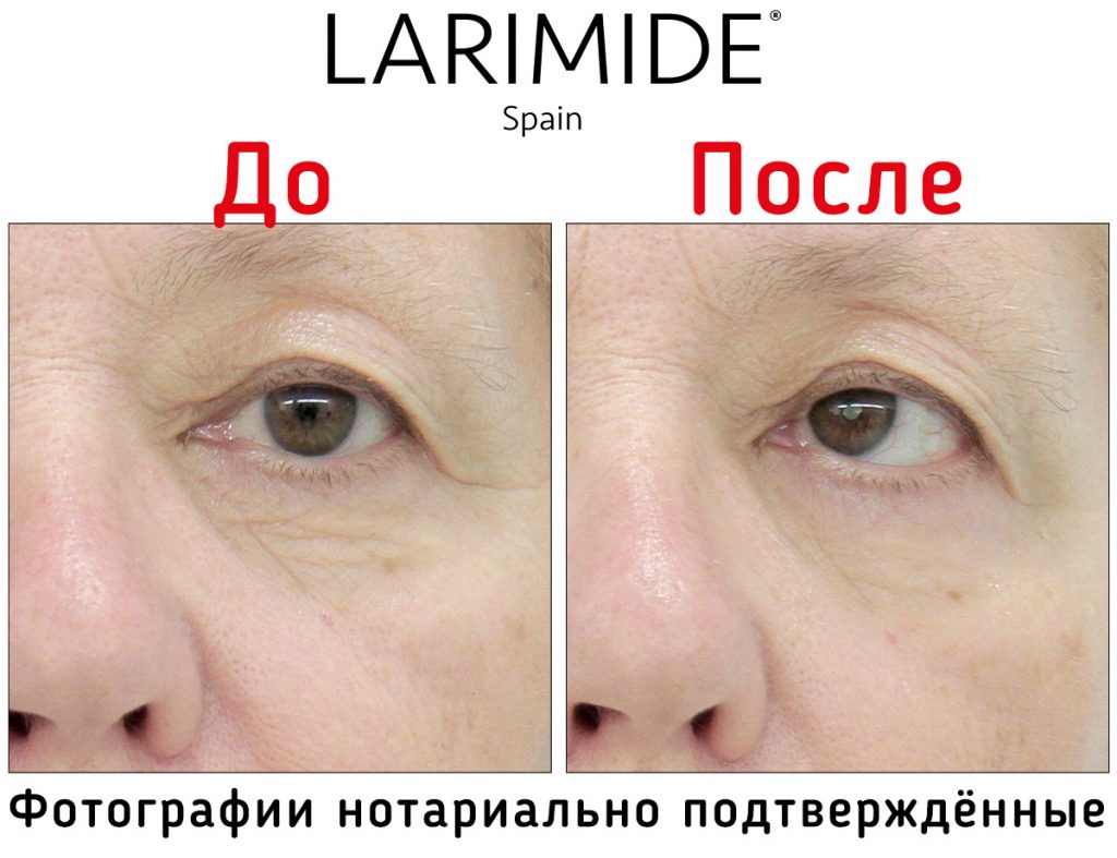 Larimide
